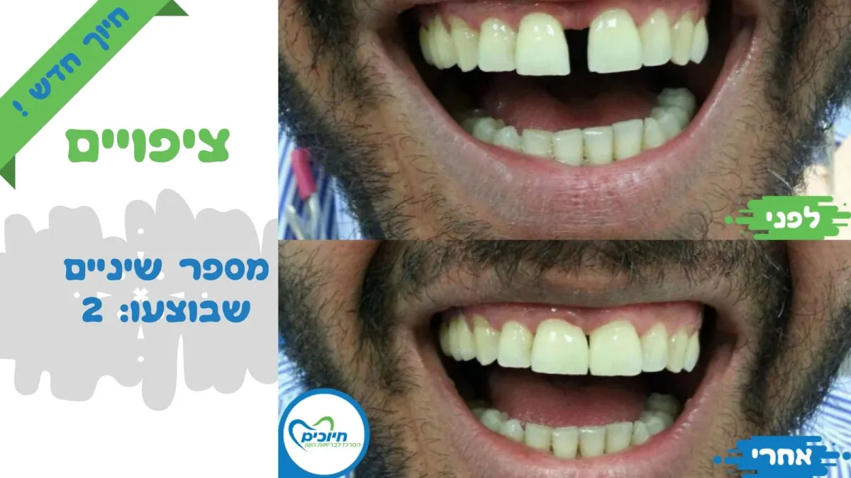 מרפאת חיוכים: תמונה 3
