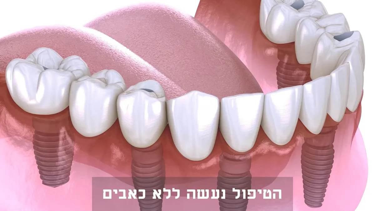Dr.Ilia Israel ALEF DENT מרפאת: תמונה 3