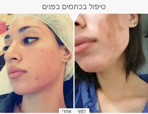 כרמי קוסמטיקה רפואית, תמונה 4