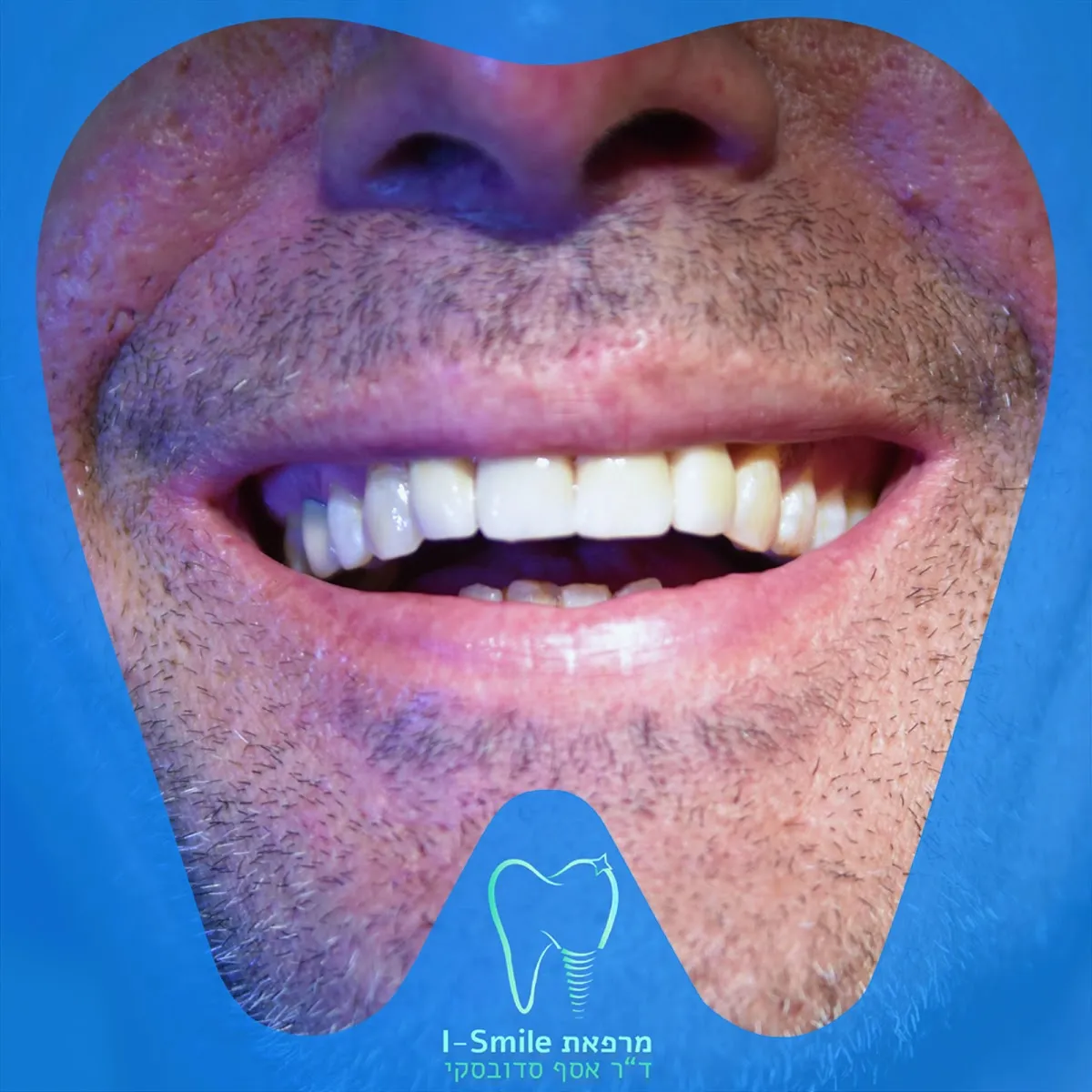 ד"ר אסף סדובסקי מרפאת שיניים בירושלים Dr.Sadovsky Jerusalem Dentist, תמונה 6