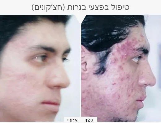 כרמי קוסמטיקה רפואית, תמונה 6
