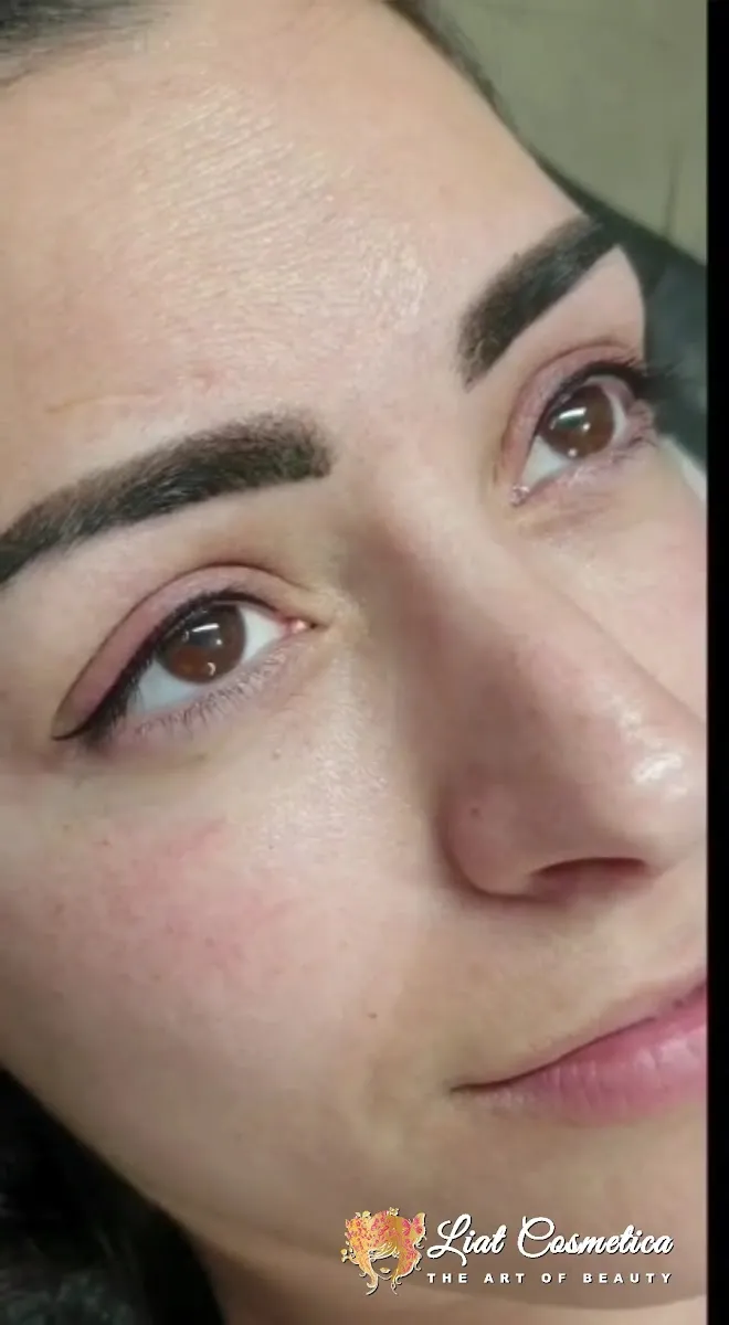 ליאת ועקנין | Liat Vaknin | Advanced Skin Solutions, תמונה 7
