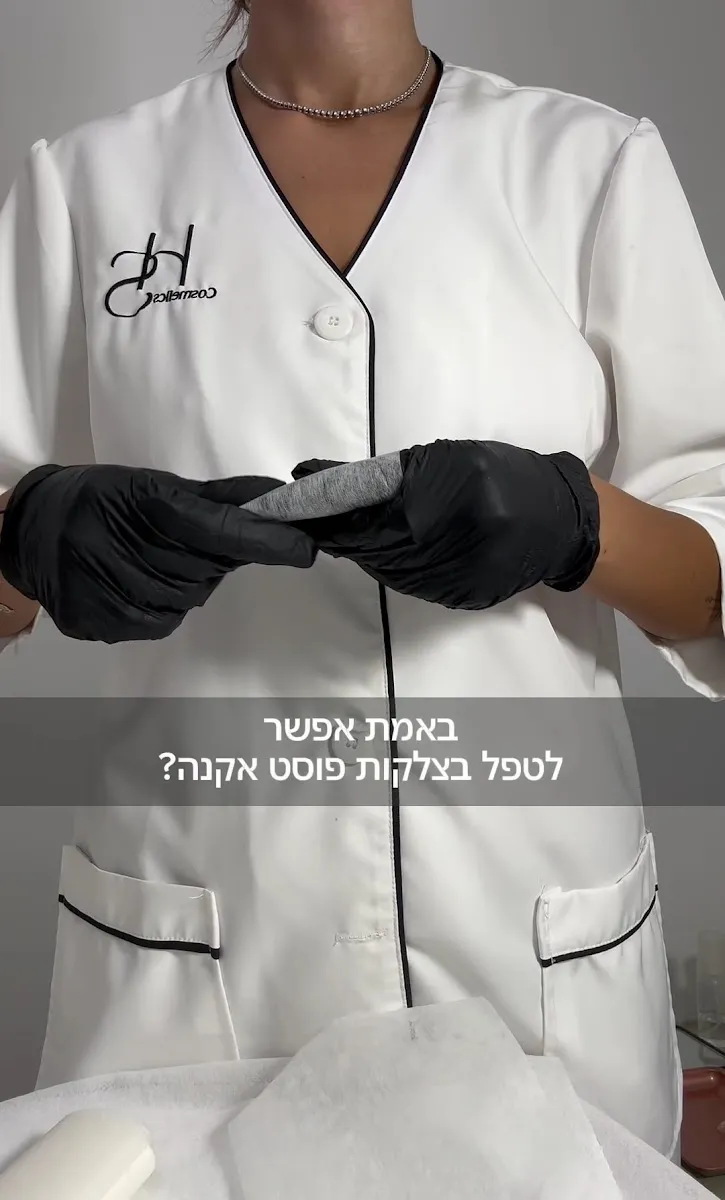 HS COSMETICS- הילה שמעון קוסמטיקאית, תמונה 7
