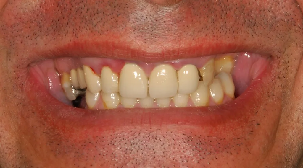 Dr. Samuel Morgolis oral: תמונה 8