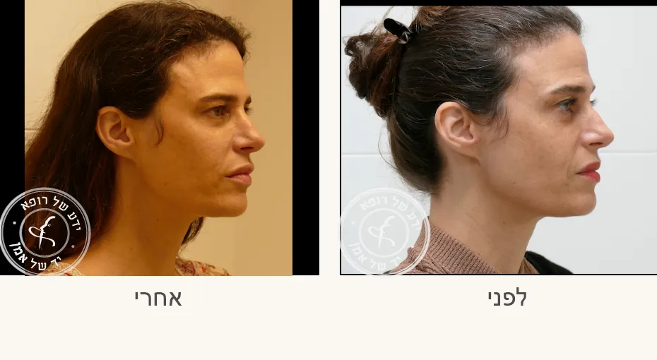 ד״ר בעז אמן כירורגיה פלסטית ואסתטית