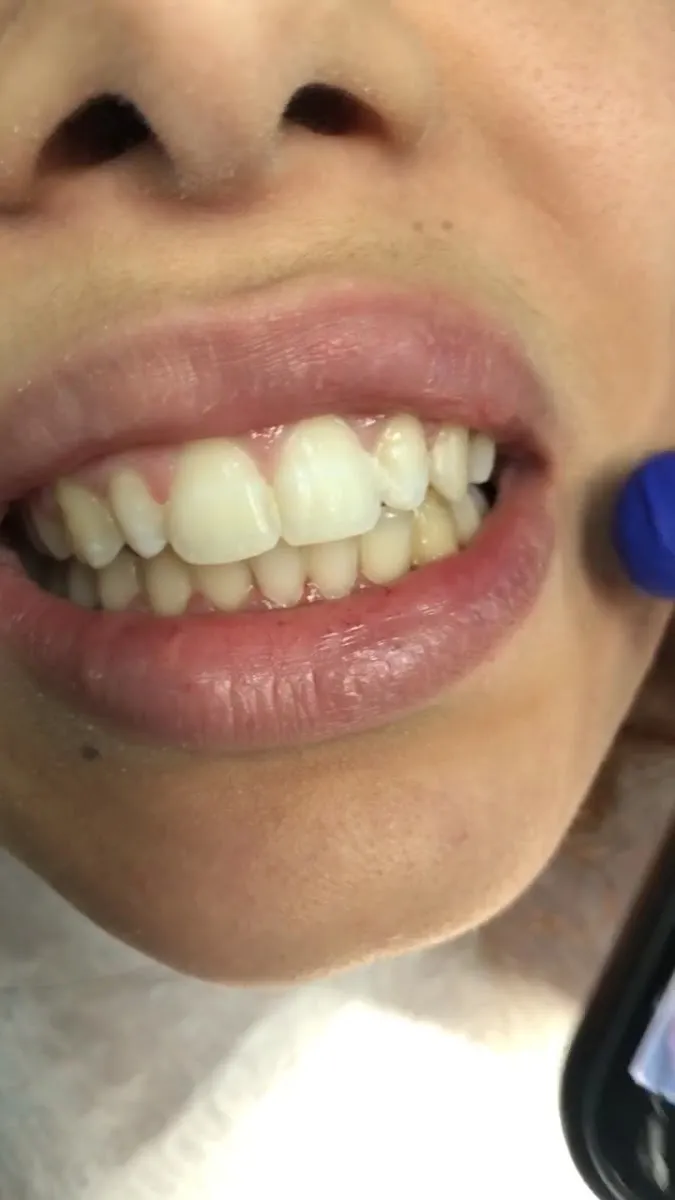 Bright Smile, תמונה 6