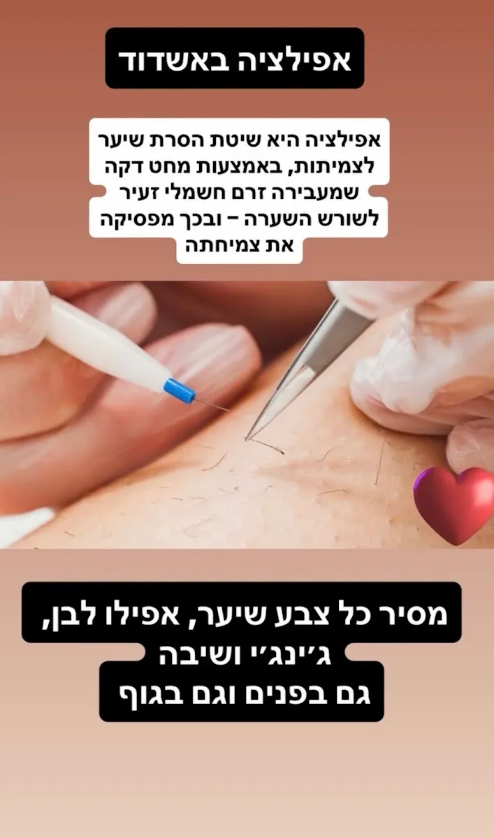 שרה שמחה - קוסמטיקה רפואית טיפולי פנים מתקדמים, תמונה 4