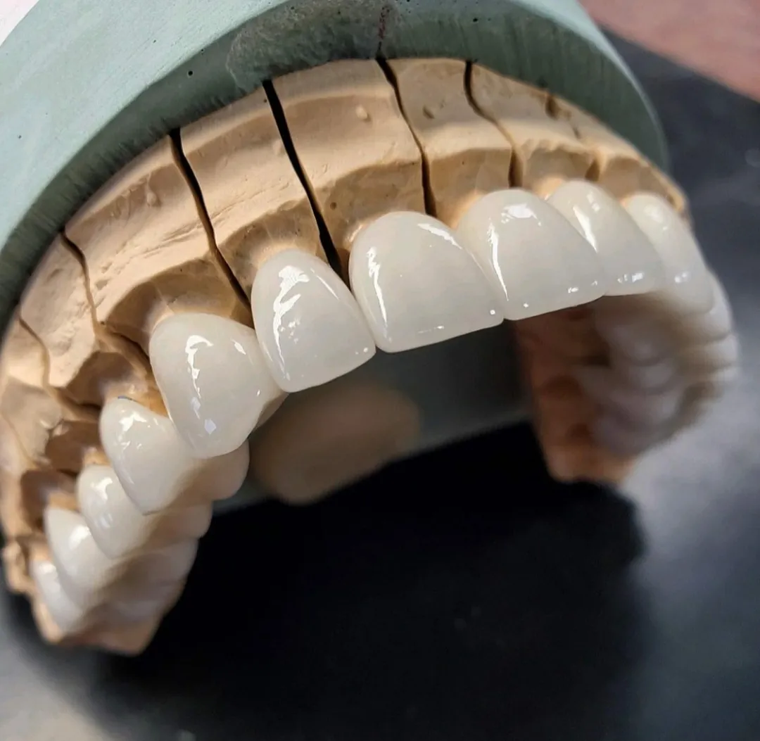 Dr Haim Aseriel Dentist, תמונה 4