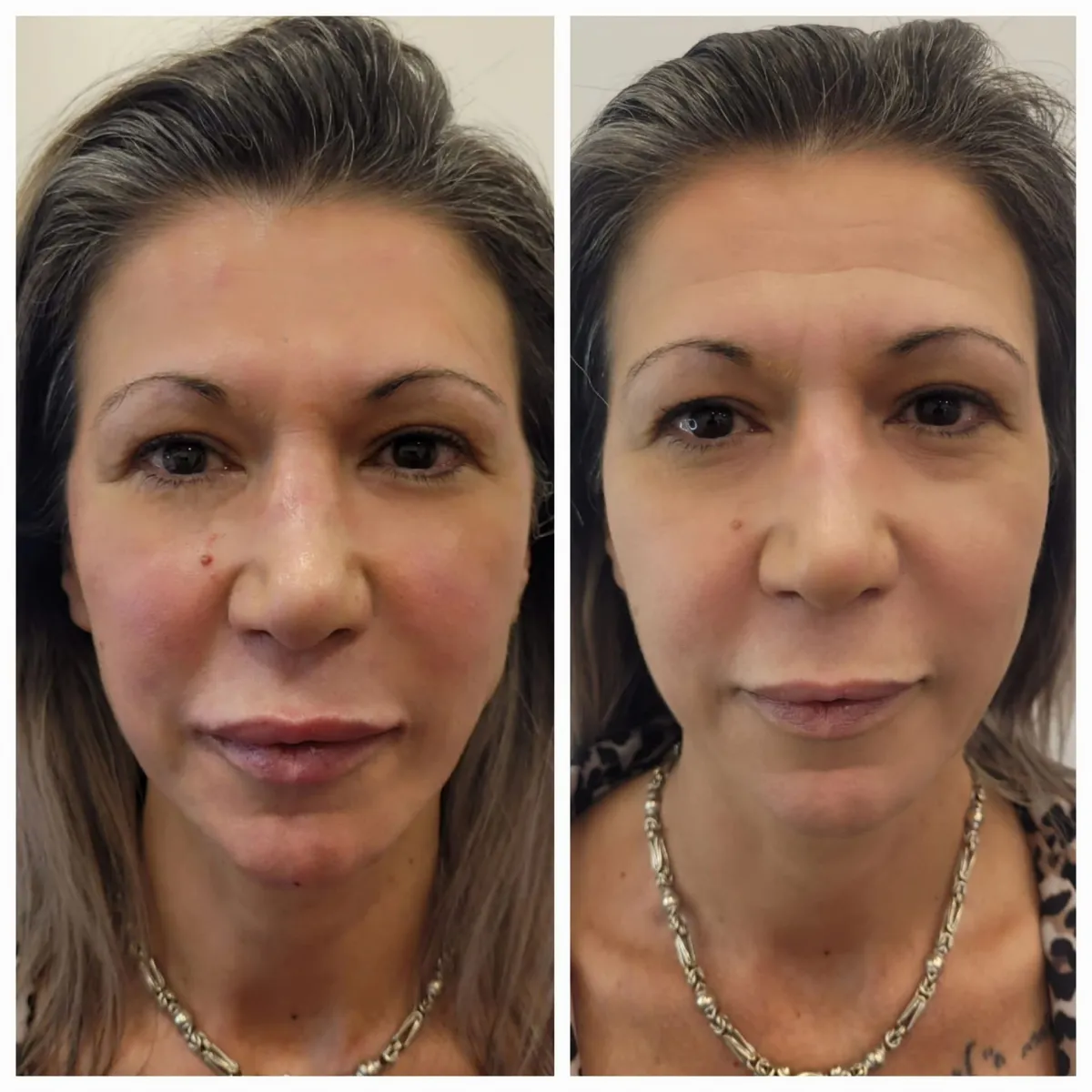 Miracle Aesthetic & Beauty Clinic: תמונה 4
