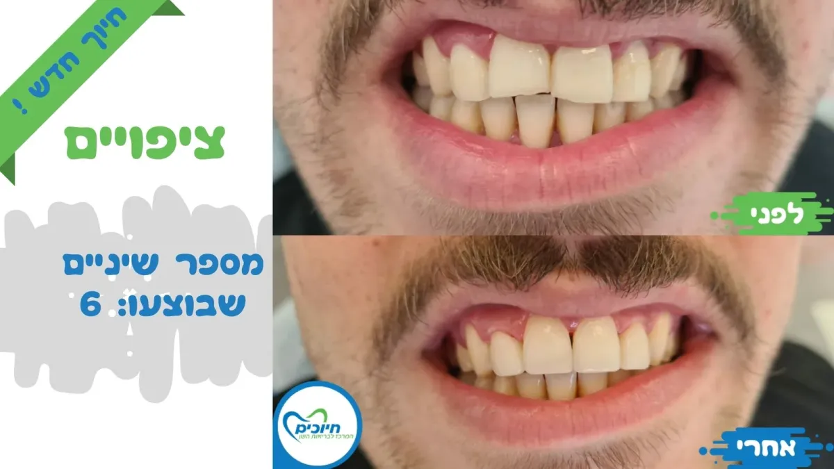 מרפאת חיוכים: תמונה 5