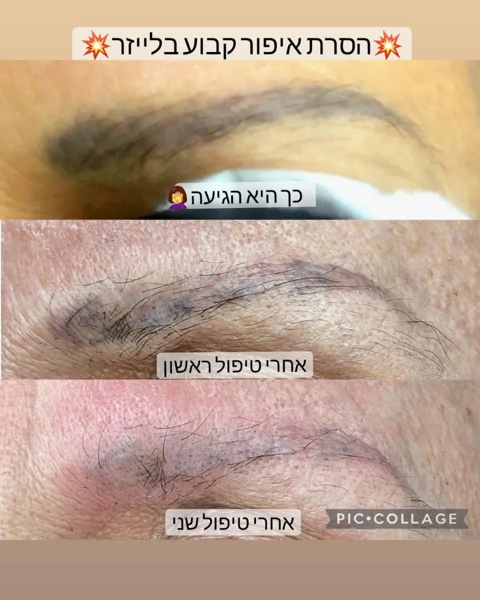זרי חמיאס, תמונה 2