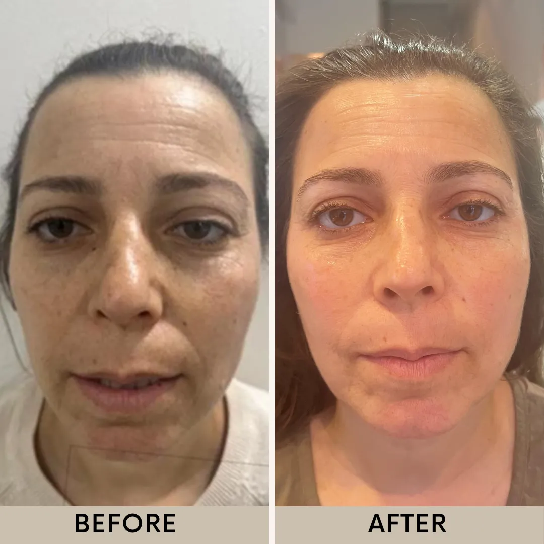 VIRGINIE institut de beauté וירג'יני קוסמטיקה מתקדמת ליופי ובריאות, תמונה 7