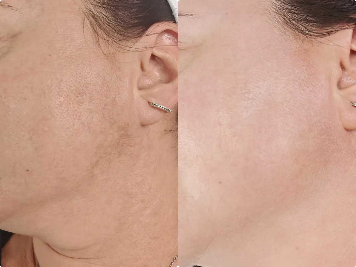 קוסמטיקאית שני גת לייזר Shani cosmetics, תמונה 5