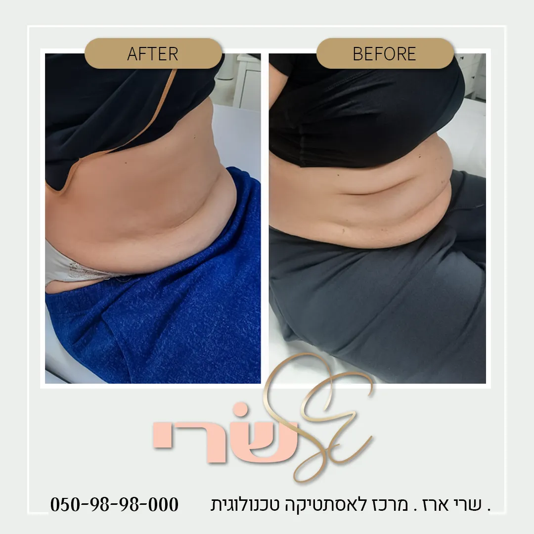 שרי ארז - מרכז לאסתטיקה טכנולוגית וקוסמטיקה רפואית, תמונה 7