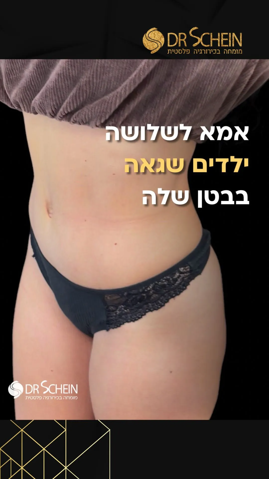 דר' שיין - מומחה בכירורגיה פלסטית, תמונה 8