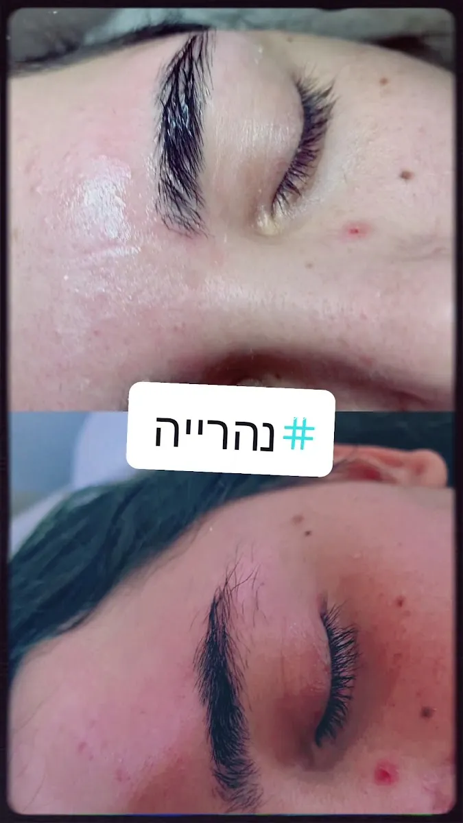 אורטל הר זהב קוסמטיקאית בנהריה, נהריה, תמונה 7