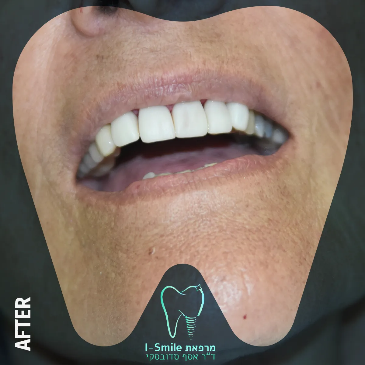 ד"ר אסף סדובסקי מרפאת שיניים בירושלים Dr.Sadovsky Jerusalem Dentist, תמונה 5