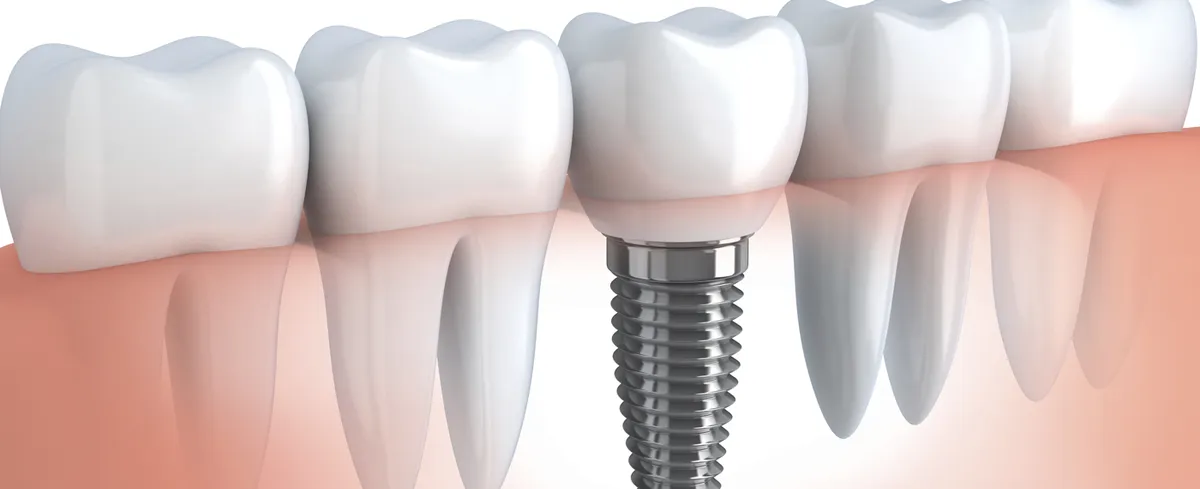 Uzi Shinfeld Laboratory and Dental: תמונה 4