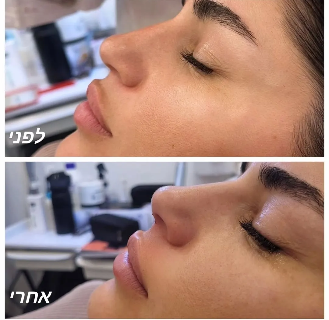 Miracle Aesthetic & Beauty Clinic: תמונה 6