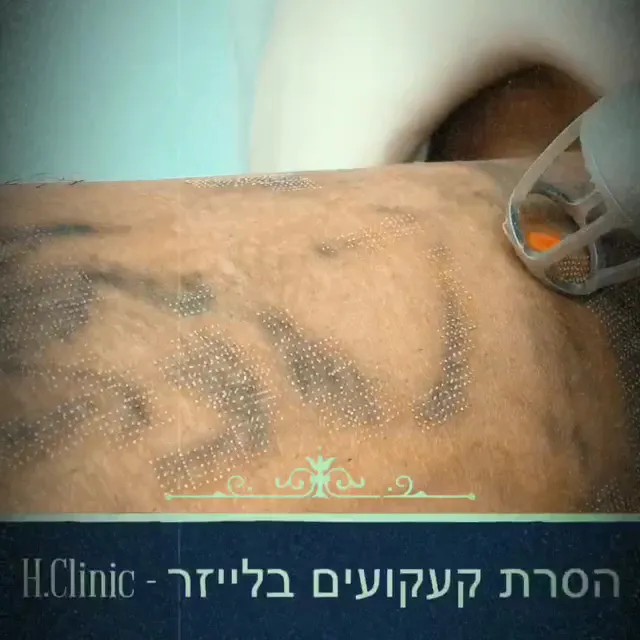 H.Clinic | לייזר ואסתטיקה, תמונה 7