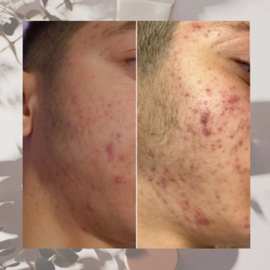 escosmetician - קוסמטיקה מקצועית, תמונה 5
