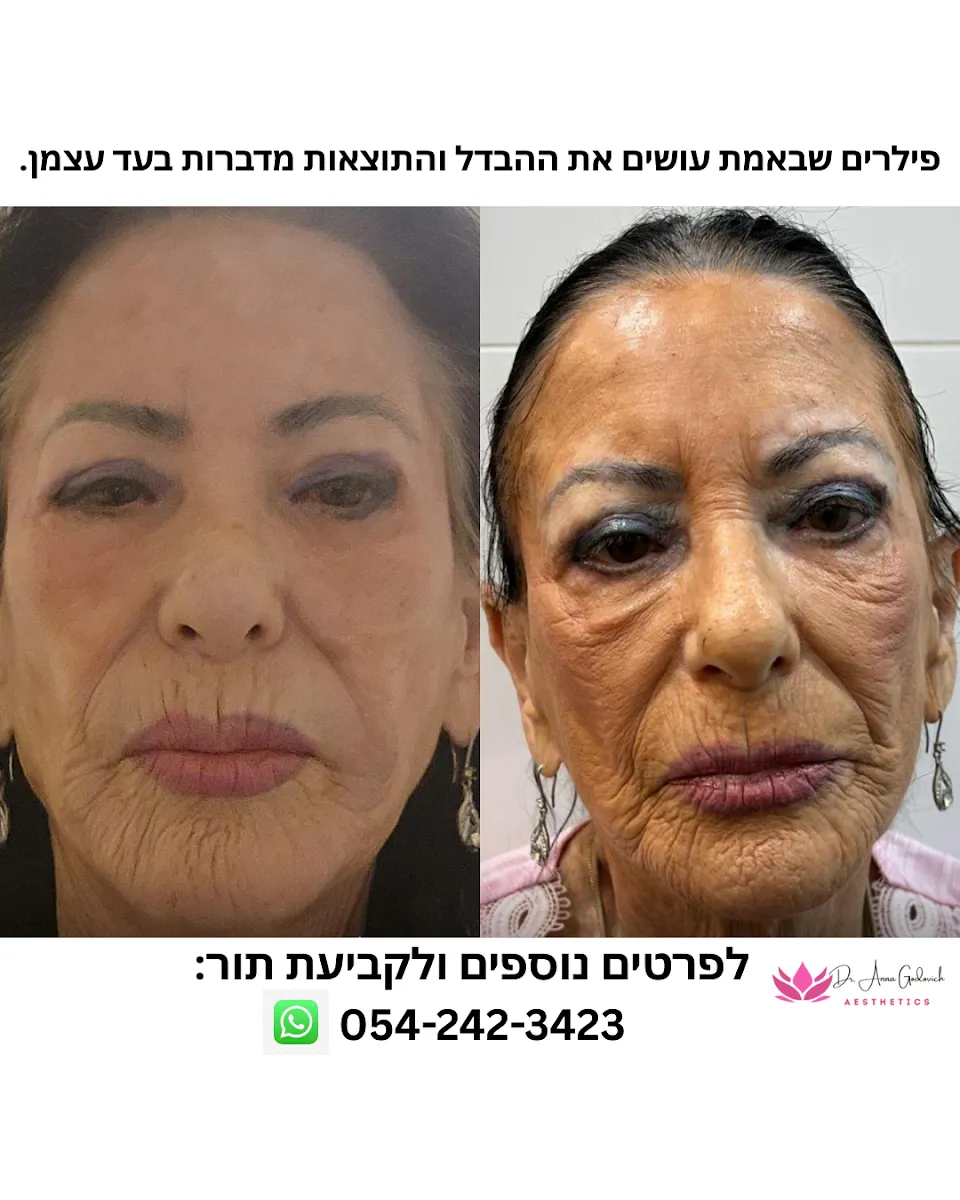 ד"ר אנה גודוביץ׳ - טיפולי אסתטיקה רפואית, תמונה 7