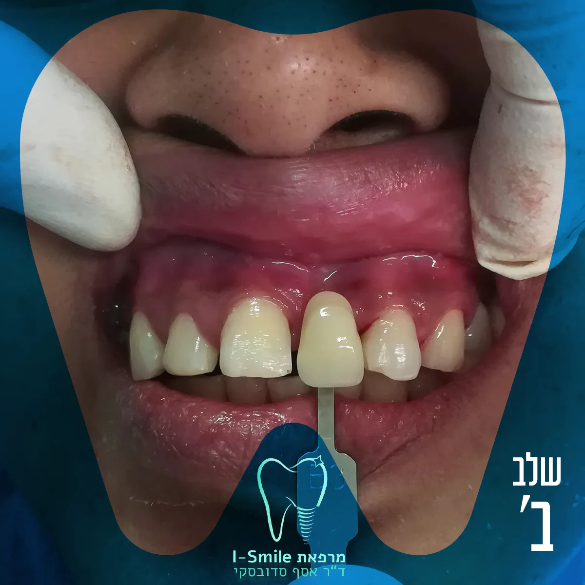 ד"ר אסף סדובסקי מרפאת שיניים בירושלים Dr.Sadovsky Jerusalem Dentist, תמונה 4